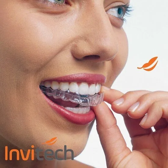 Tong quan ve nieng rang invitech Tong quan ve nieng rang invitech