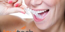 Cơ hội vàng niềng răng tại nha khoa Việt Úc