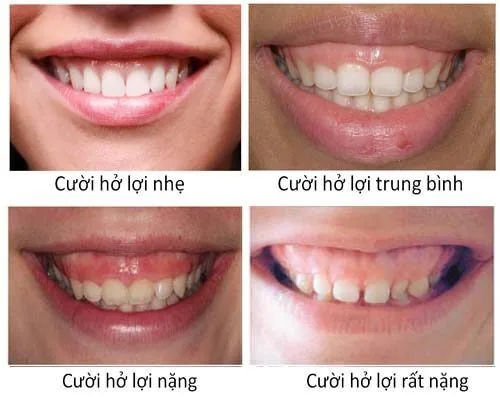Chua cuoi ho loi Chua cuoi ho loi