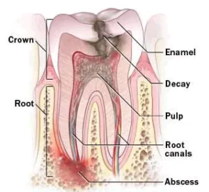 root2