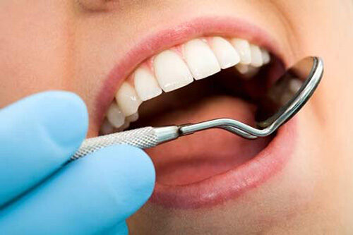  Quá trình bọc răng sứ thế nào cho tốt ?