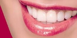 Khi nào nên bọc răng sứ cho răng hàm và tuổi thọ răng đã bọc sứ?