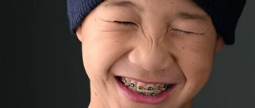 Nieng rang tre em va nhung dieu ban nen biet Nieng rang tre em va nhung dieu ban nen biet