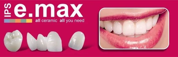 boc rang su emax 2
