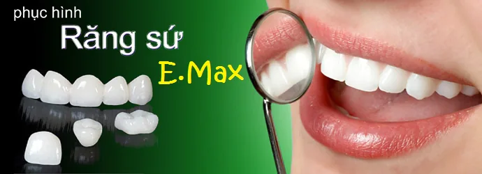 boc rang su emax