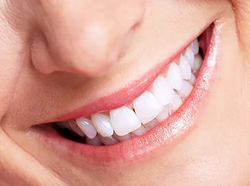 tai sao nen lua chon cay implant khi mat rang 4 tai sao nen lua chon cay implant khi mat rang 4