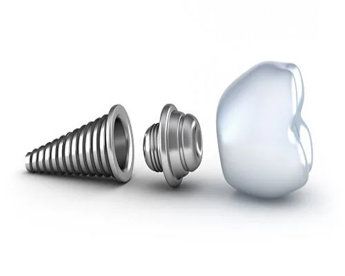 Trong implant nhu the nao Trong implant nhu the nao