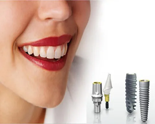 trong-implant-mat-bao-lau trong-implant-mat-bao-lau