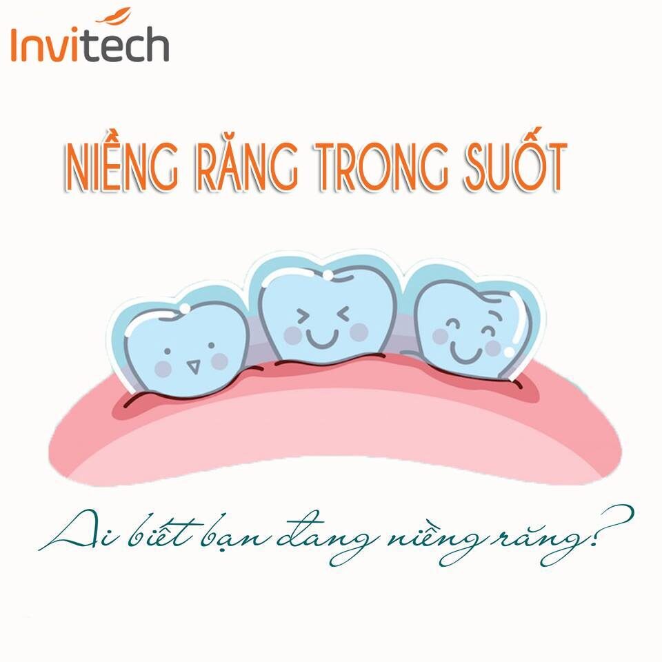 Niềng răng trong suốt giá bao nhiêu?