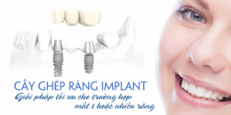 5 yếu tố ảnh hưởng đến việc trồng răng implant