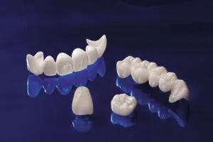 bọc răng sứ bao nhiêu tiền