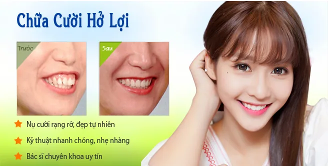phau thuat cuoi ho loi hieu qua tai viet uc 1