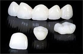Trồng răng sứ giá bao nhiêu phụ thuộc vào chất liệu bạn lựa chọn.