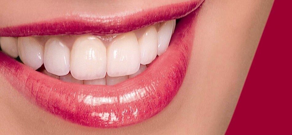Trồng răng sứ giá bao nhiêu để đạt hiệu quả mong muốn?