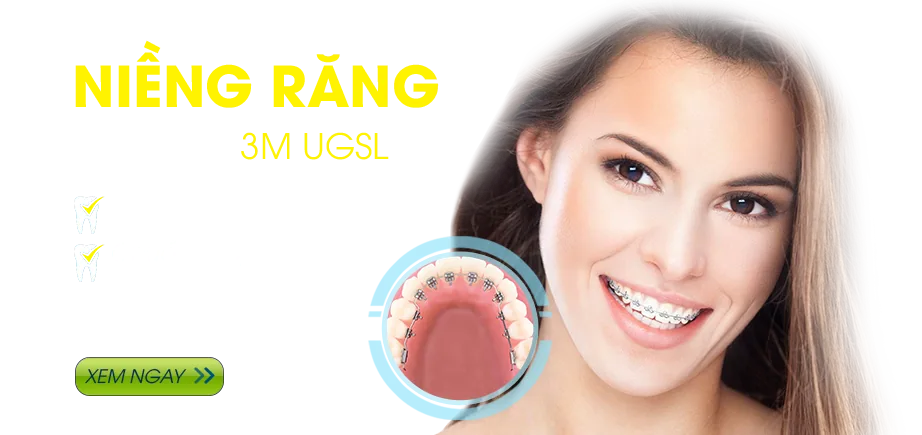 chăm sóc sau niềng răng cham-soc-sau-nieng-rang
