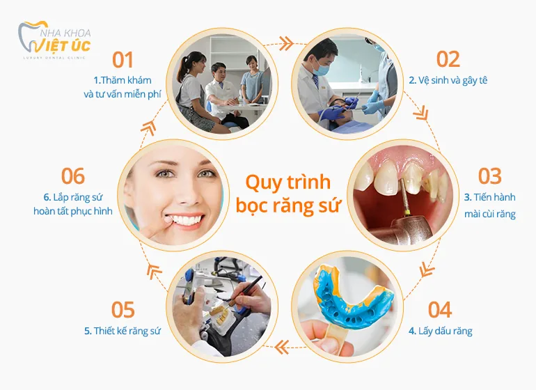 Quy trình bọc răng sứ tại nha khoa Việt Úc Quy trình bọc răng sứ tại nha khoa Việt Úc