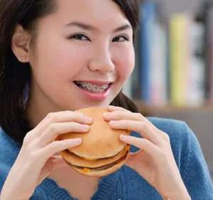 Thói quen ăn uống ảnh hưởng đến thời gian niềng răng bao lâu