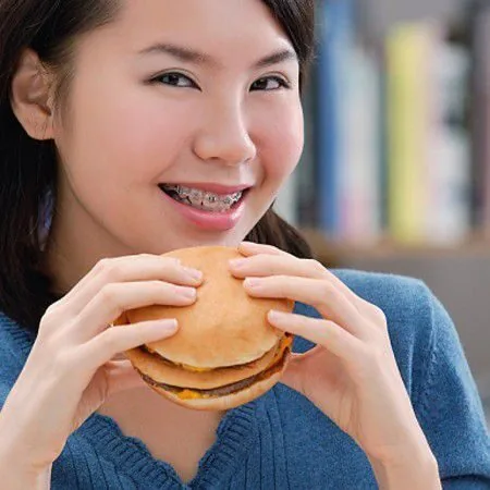 Thói quen ăn uống cũng ảnh hưởng tới thời gian niềng răng mất bao lâu nieng rang mat bao lau cho hieu qua tot nhat 1