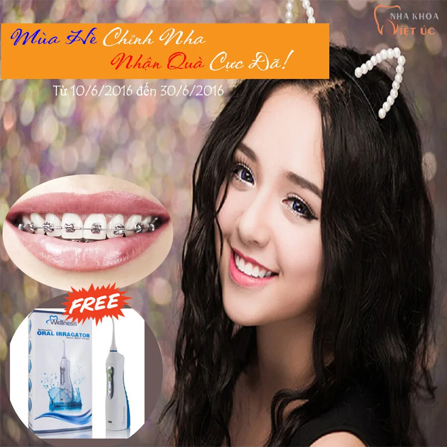 Mùa hè chỉnh nha - Nhận quà cực đã