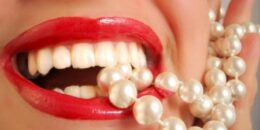 Cách chăm sóc sau răng miệng khi bọc răng sứ Titan