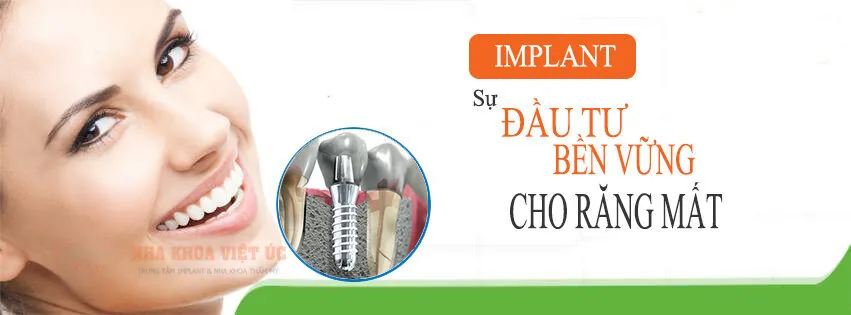 trong rang implant