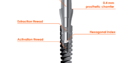 Trồng răng implant Tekka – Giải pháp implant số 1 tại Pháp