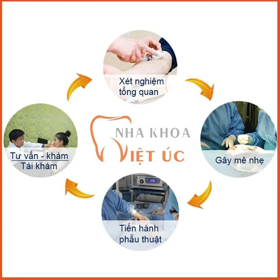 Quy trình điều trị cười hở lợi bằng phương pháp phẫu thuật