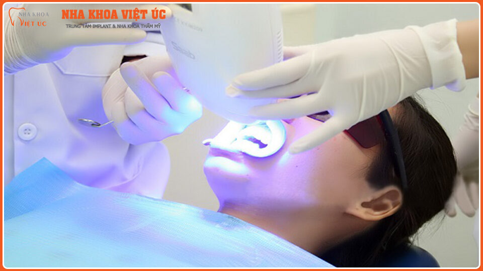 Hình ảnh bệnh nhân tẩy trắng răng tại Nha Khoa Việt Úc.
