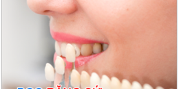 Bọc răng sứ là gì? Những trường hợp nào nên bọc răng sứ?