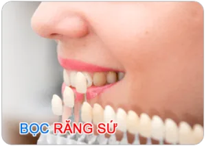 Bọc răng sứ bao nhiêu tiền