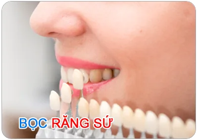 Bọc răng sứ là gì? Những trường hợp nào cần bọc răng sứ?