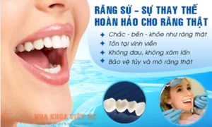 Nên bọc răng sứ giá bao nhiêu tiền là hợp lý?