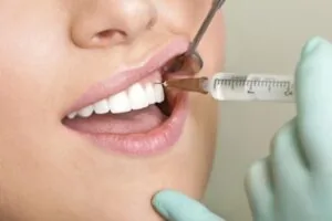 Chữa cười hở lợi bằng tiêm hoạt chất