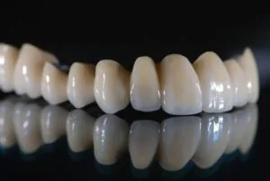 Bọc răng sứ Titan có tốt không?