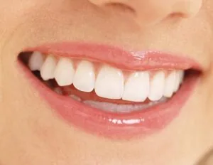 Bọc răng sứ loại nào tốt nhất hiện nay?