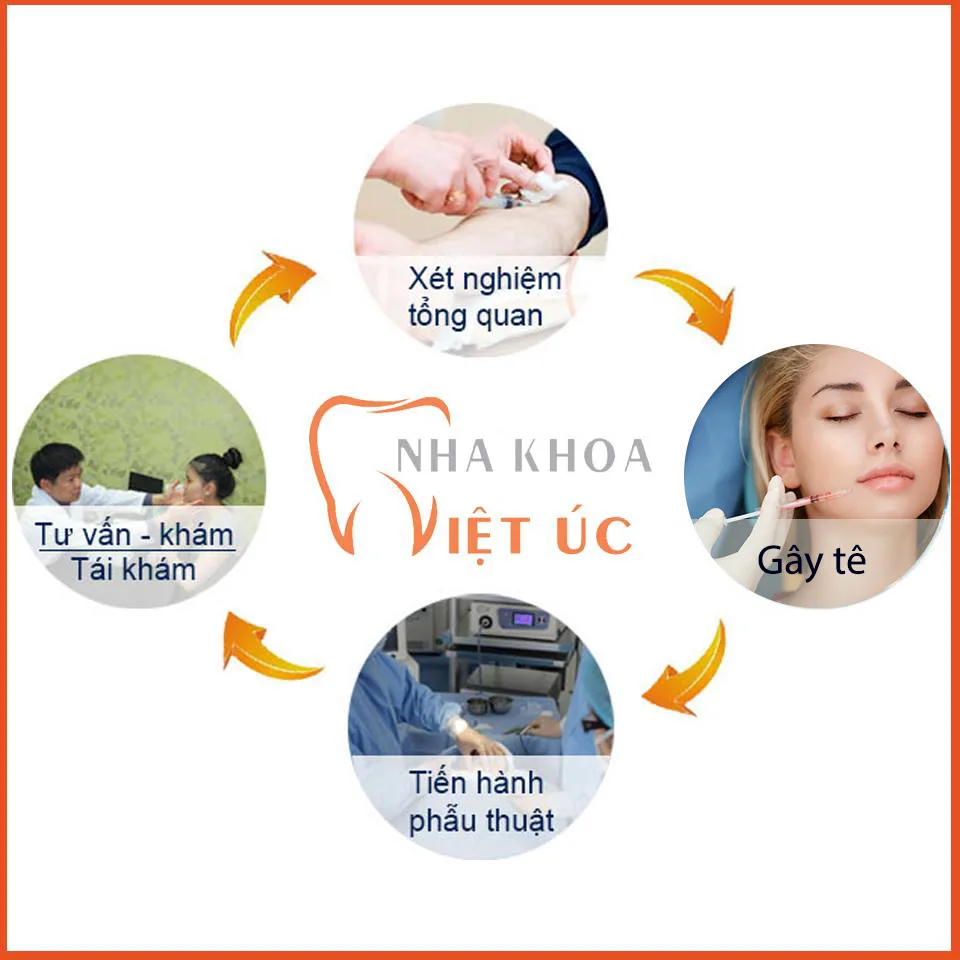 Tổng quan về quy trình chữa cười hở lợi