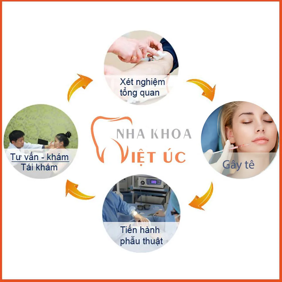 Tổng quan về quy trình chữa cười hở lợi