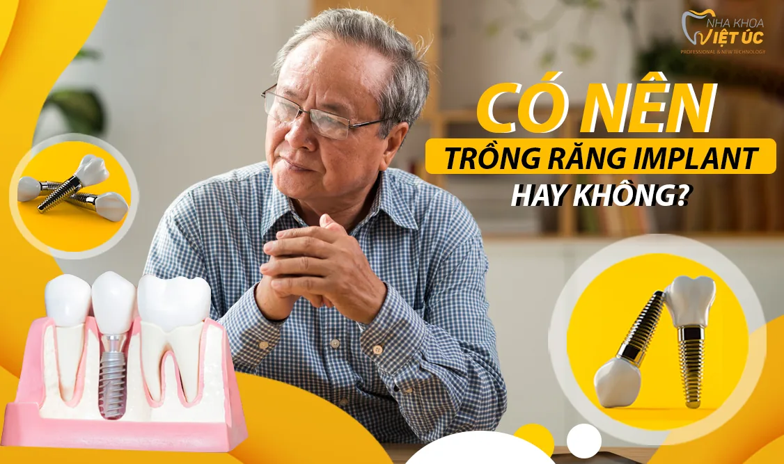 tac dung cua viec trong rang Implant