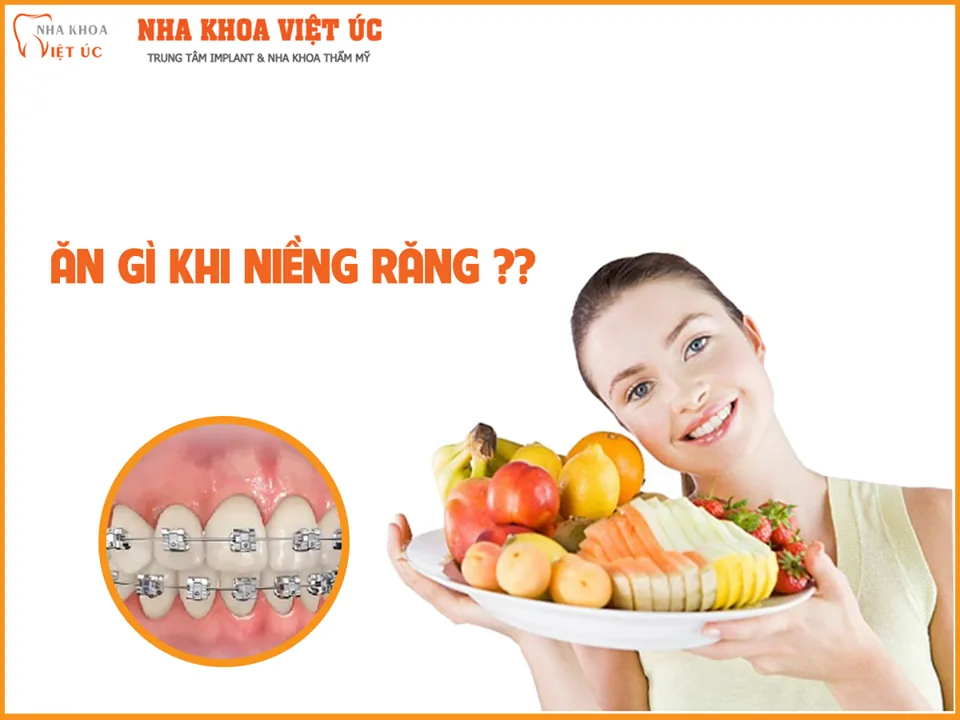 Nên ăn gì khi niềng răng thẩm mỹ?