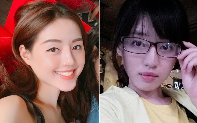 Guong mat cua Khanh Linh The Face sau khi nang mui