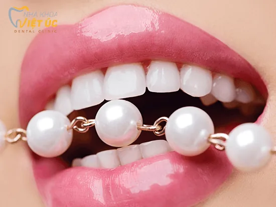 Mat dan su Veneer cho nu cuoi hoan hao