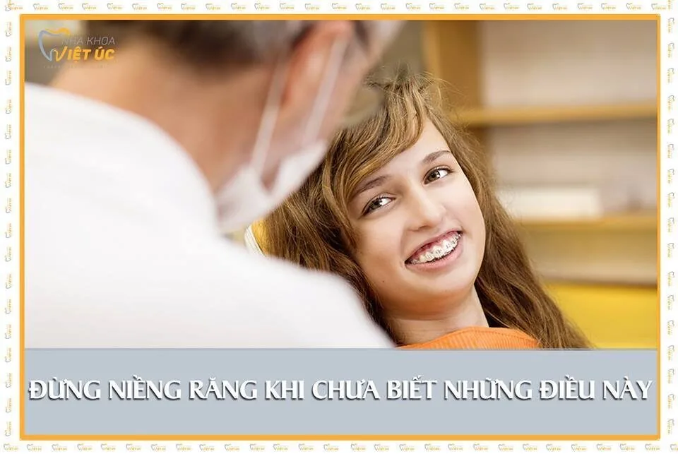Nhung dieu ban can biet truoc khi nieng rang