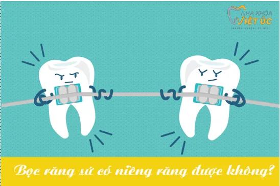 Răng bọc sứ có niềng được không Rang boc su co nieng duoc khong