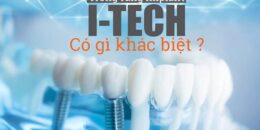 Trồng răng Implant I-Tech – Công nghệ phục hình răng đã mất số 1 thế giới