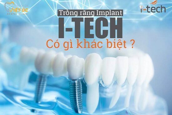 cong nghe trong rang Implant Itech