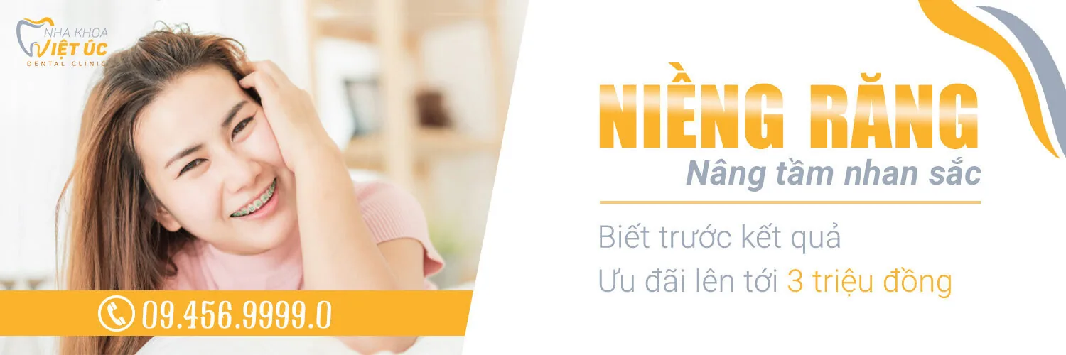 Niềng răng thẩm mỹ - Nâng tầm nhan sắc