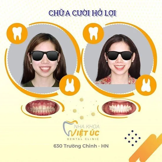 chua cuoi ho loi