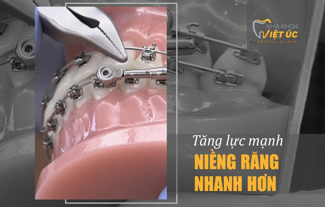 8 quan niem sai lam ve chinh nha