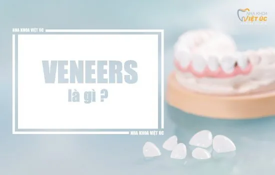 veneers la gi