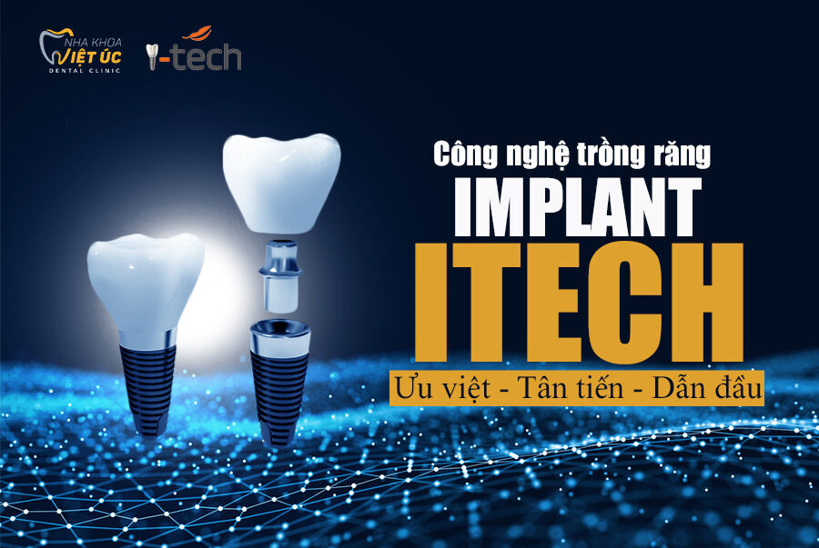 Tư vấn trồng răng Implant từ bác sĩ chuyên khoa